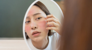 Chăm sóc da nhạy cảm Nguyên tắc