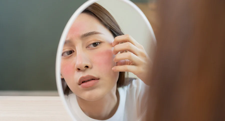 Chăm sóc da nhạy cảm Nguyên tắc