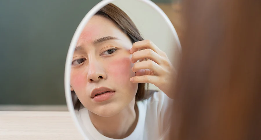 Chăm sóc da nhạy cảm Nguyên tắc 