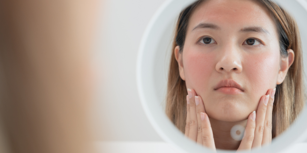 Chăm sóc da khi bị stress