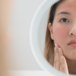 Chăm sóc da khi bị stress